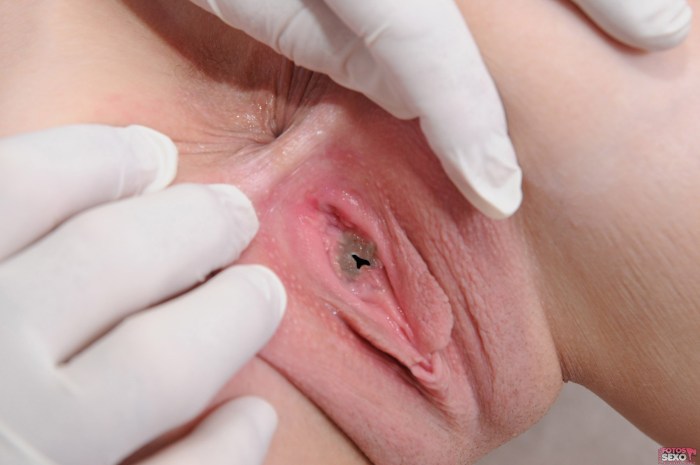 Women's vagina virgin