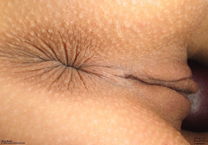 Beautiful anus