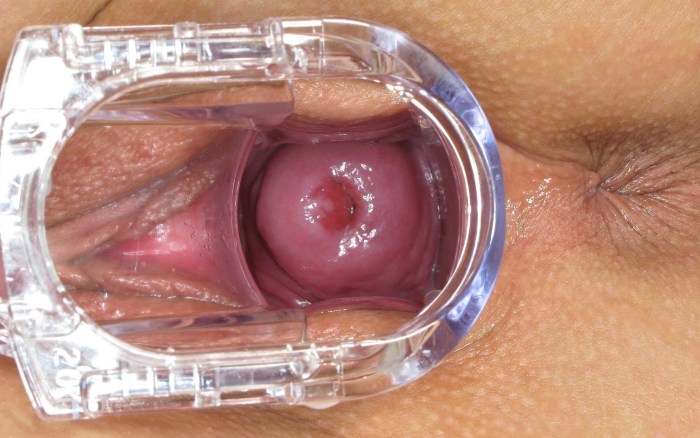 Excited vagina