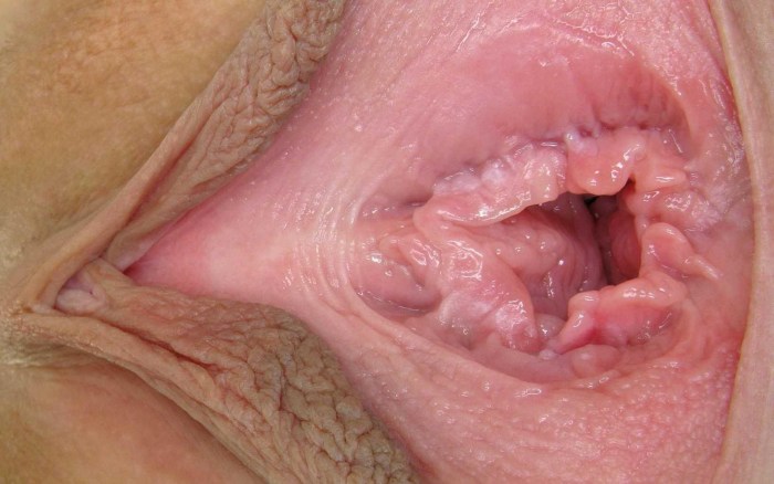 The camera inside the vagina