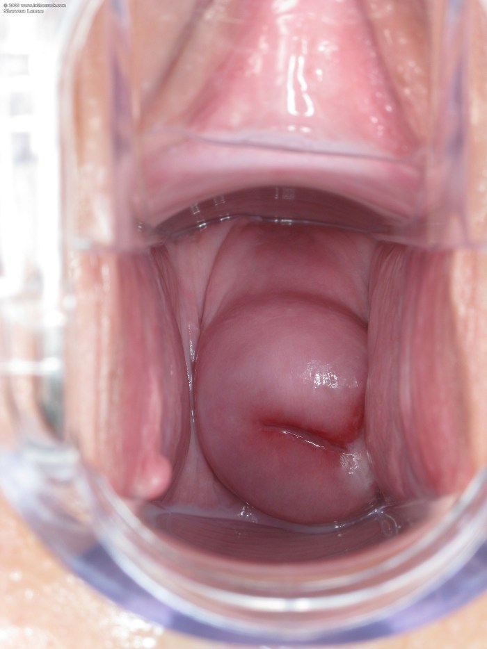 The uterus inside the vagina