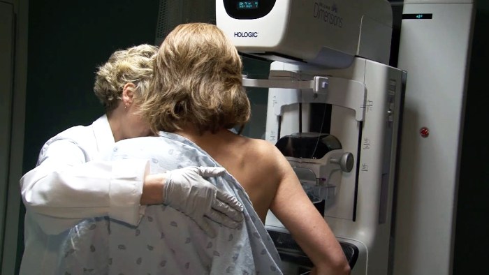 Celebrities of the sick breast cancer