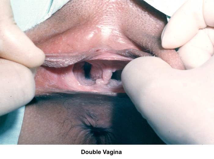 Sheena Shaw and Vaginal Expande