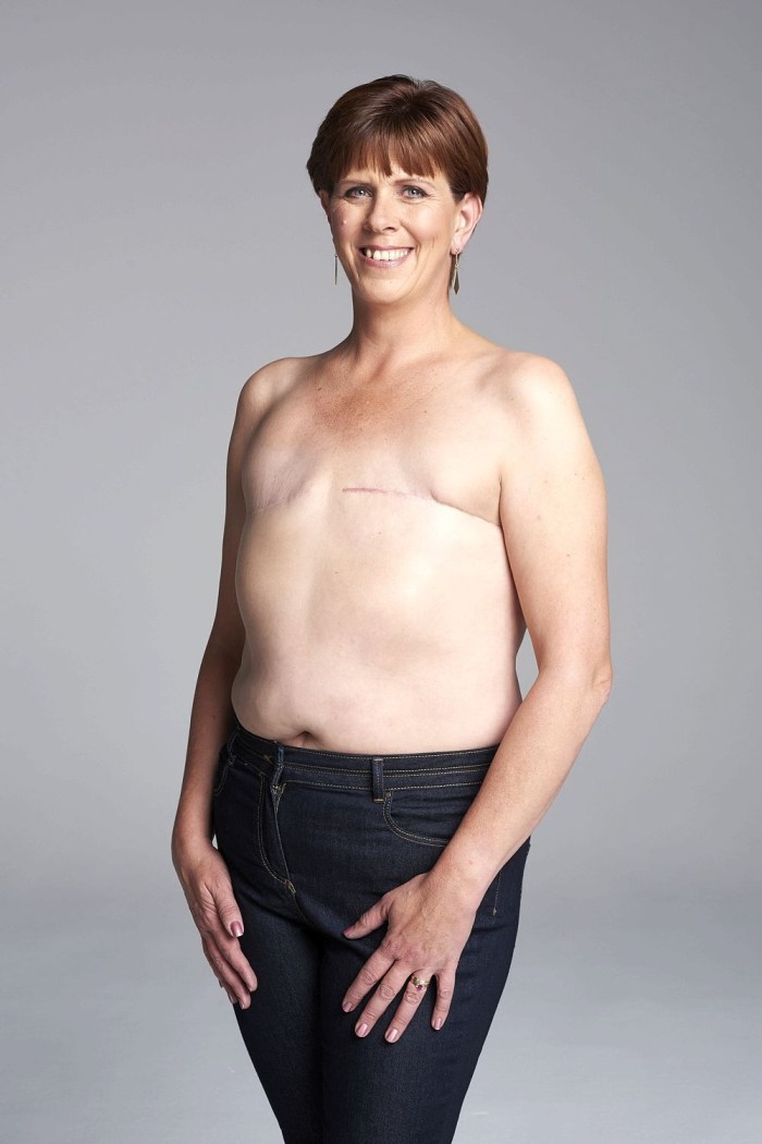 A woman without a chest