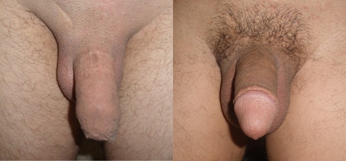 Naked women from different sides