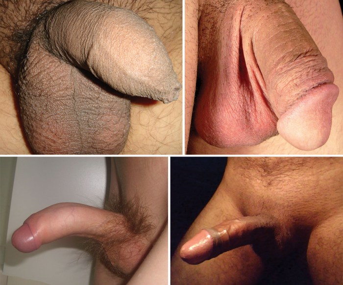 Different figures of naked women