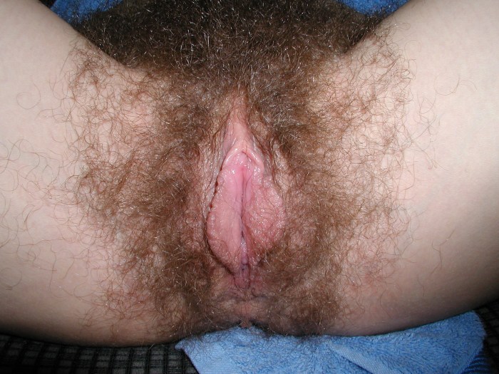 Red hairy clitoris