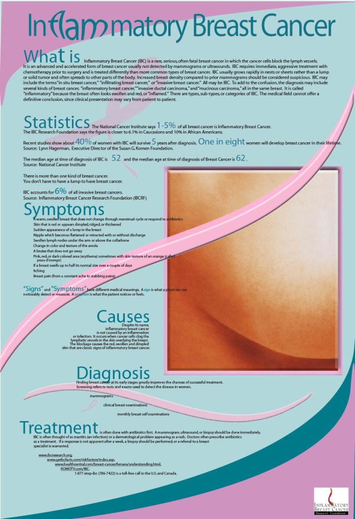 Breast Cancer Static