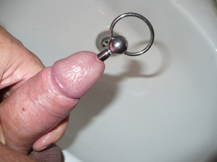 Erectational rings on the penis