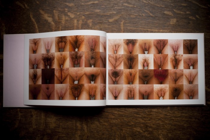 High location of the vagina