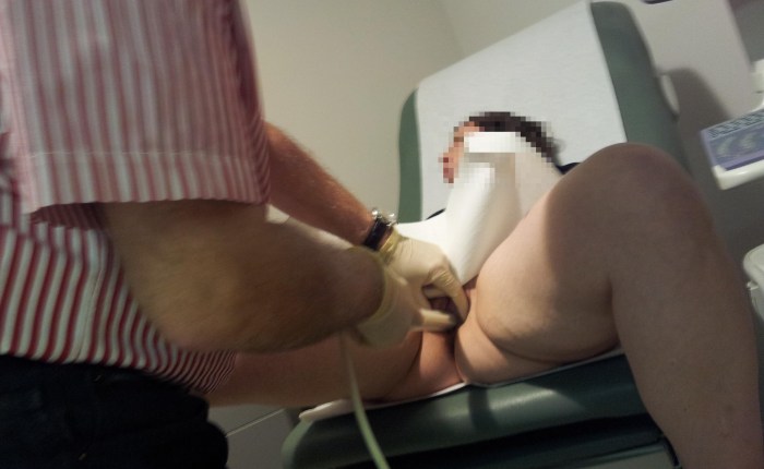 Naked women in a gynecological chair hidden