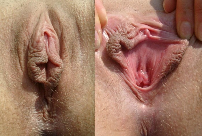Unusual genital organs in women