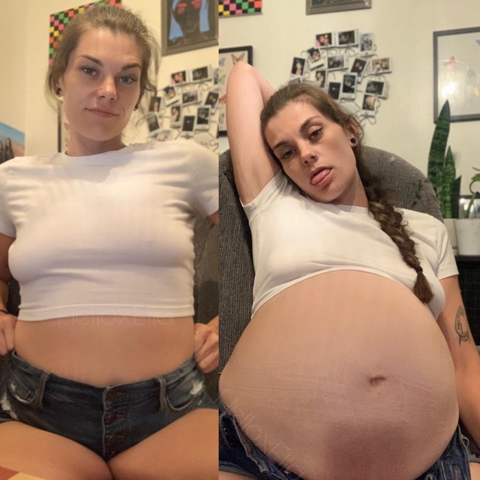 Pregnancy Annet