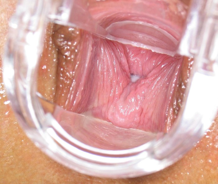 Open vagina Jamie Lynn