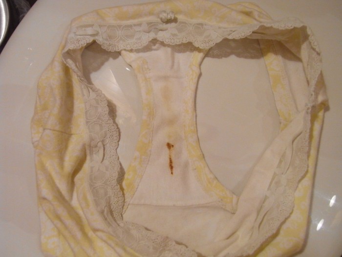 Lingerie from the seventies