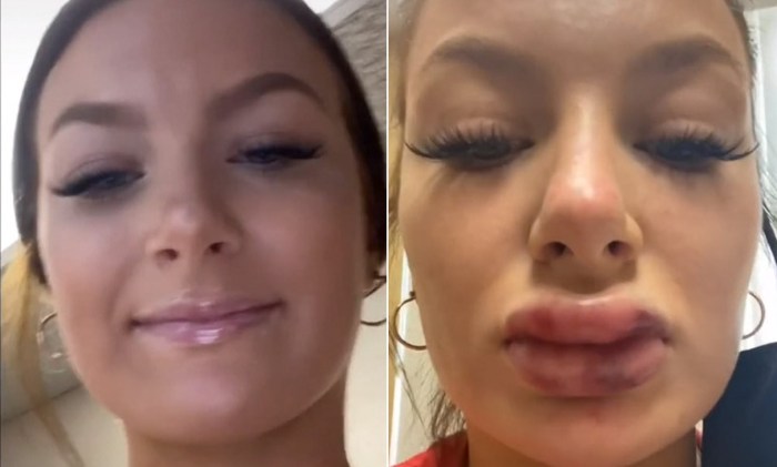 Beautiful lips are lower