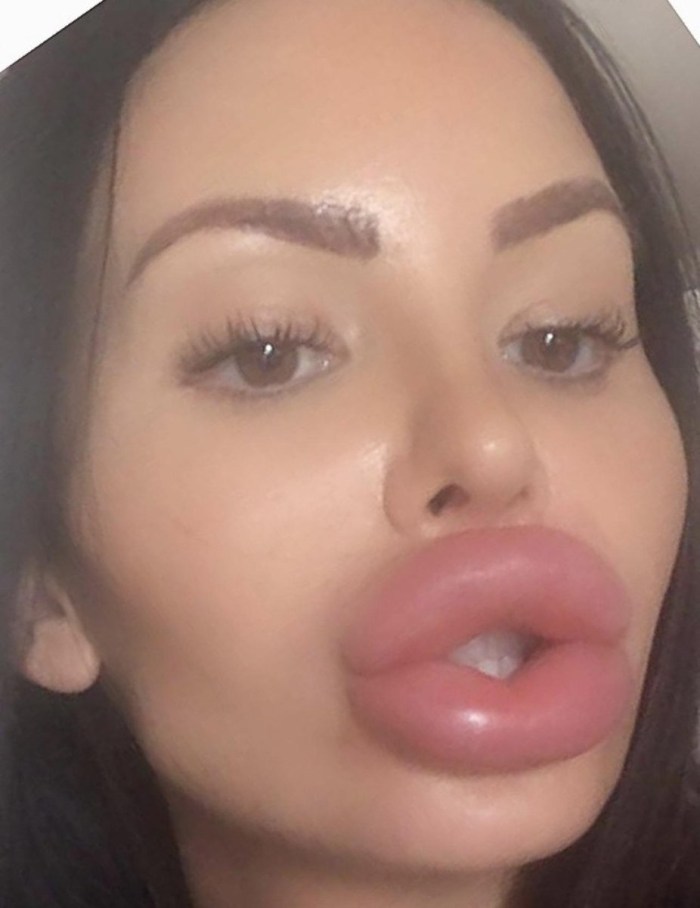 Kiss lips aesthetics