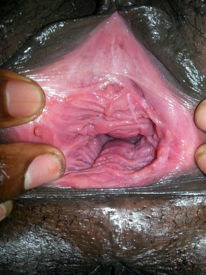 Wife vagina after childbirth
