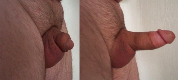 Cut off without an erection