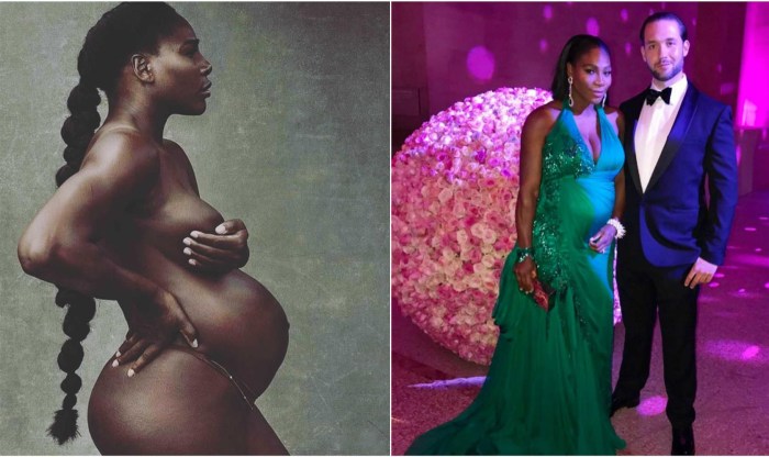 Serena Williams breast
