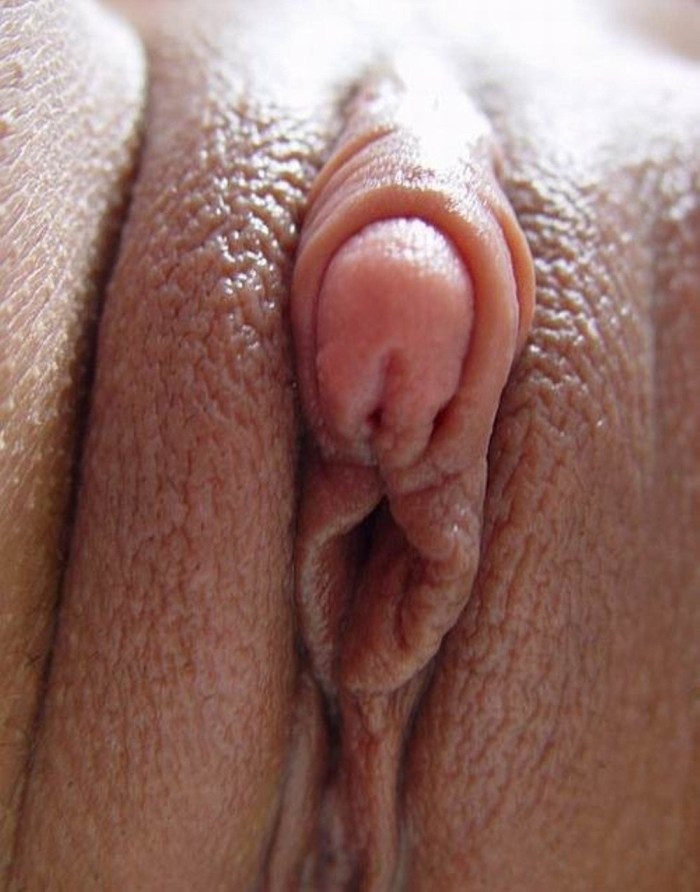 Excited genitals