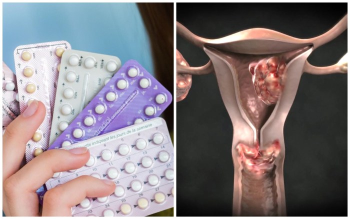 Contraceptives for women