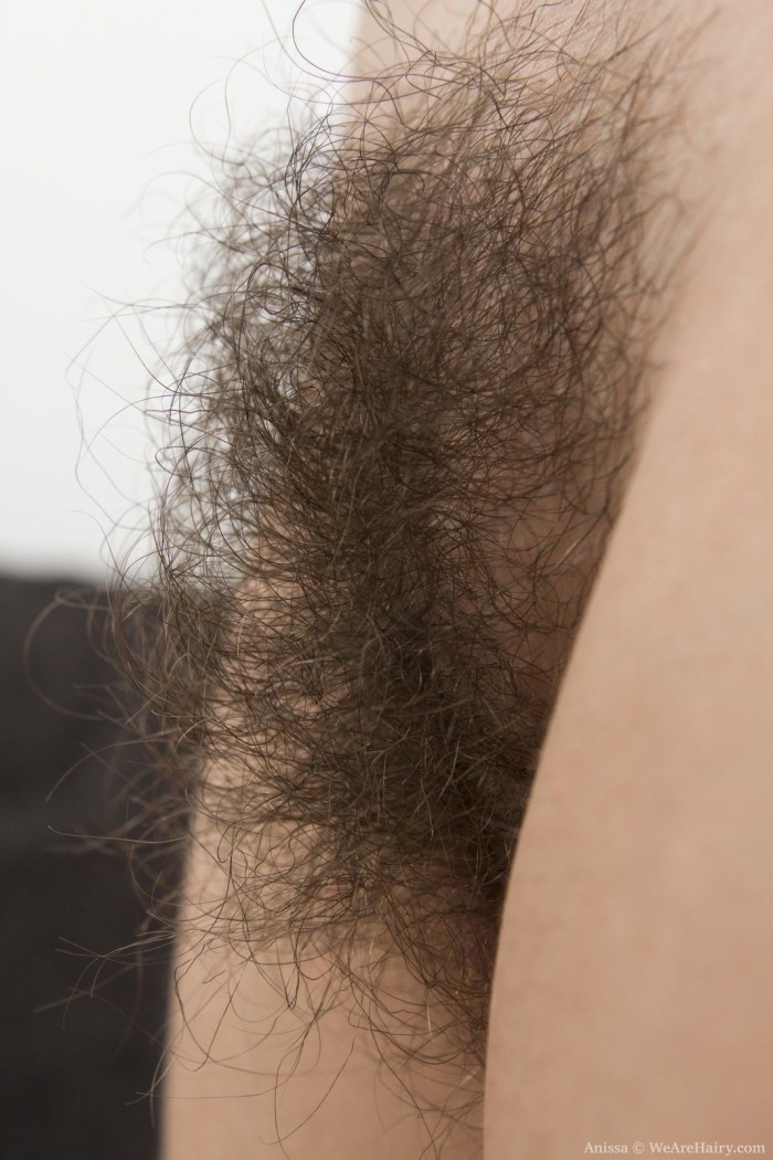 The most hairy female pubis