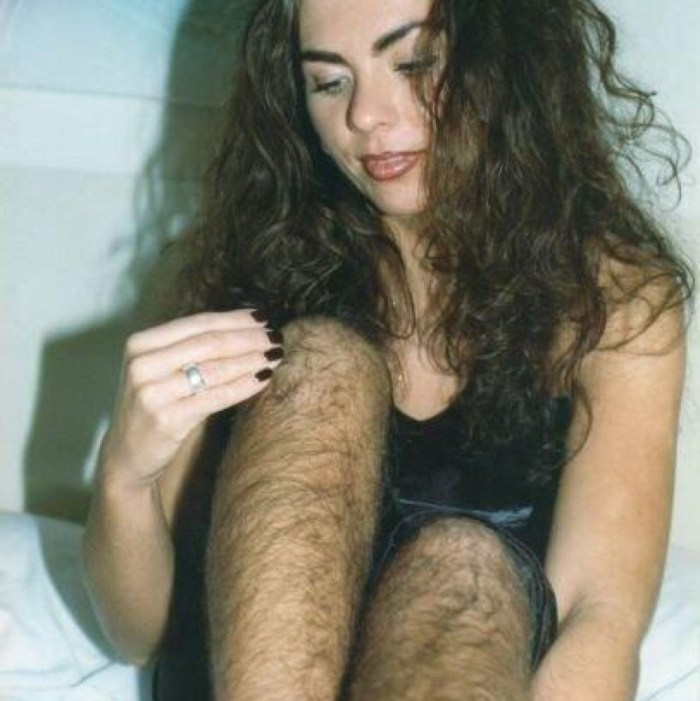 Girl with no birty legs