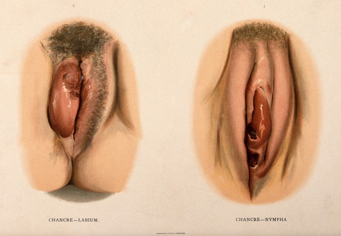 Pictures of the female genital organs
