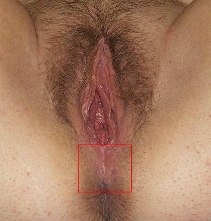 Lube hair close -up