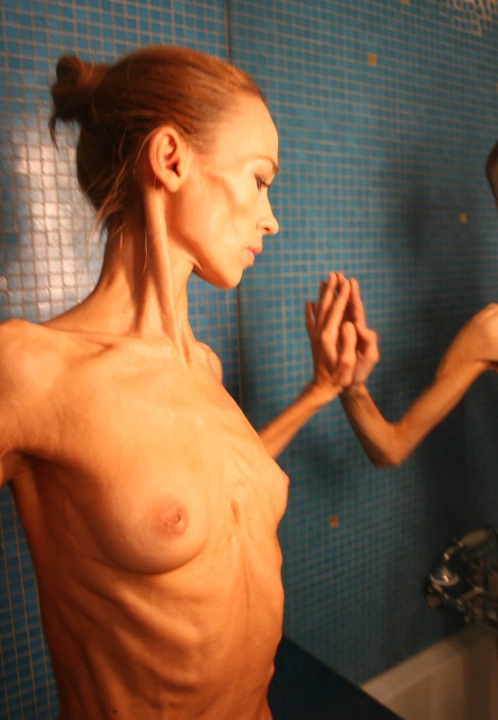 Naked thin anorexics
