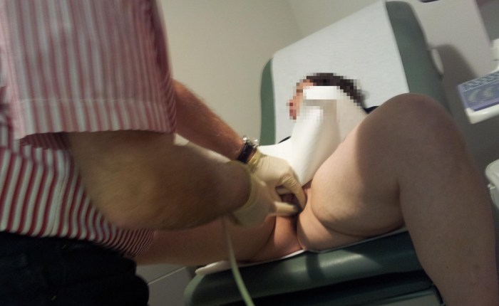 Masturbation of a nurse