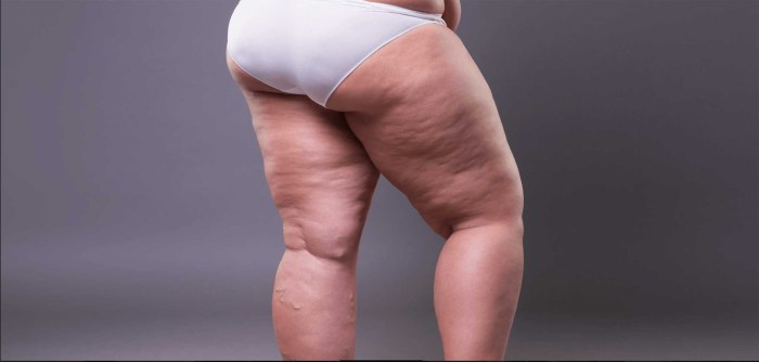 SSBBW Naked photo shoot between the legs