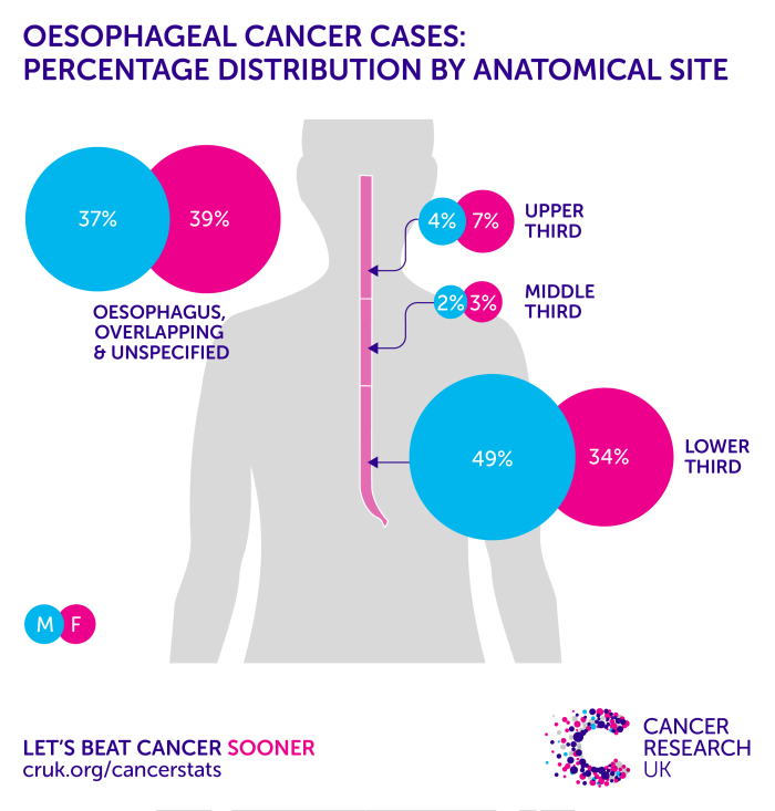 Breast Cancer Diagnosis and Screening