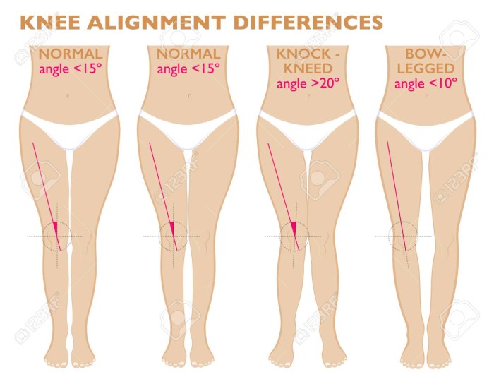 Foot shape in women