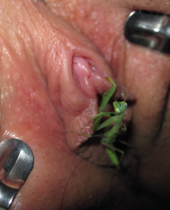 Insect bites in the vagina