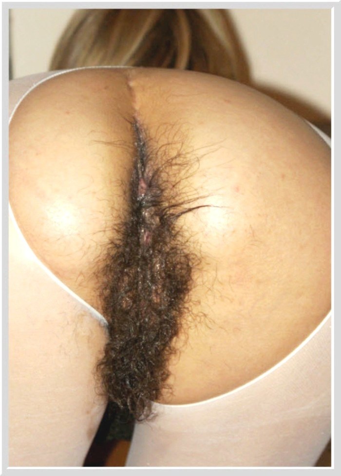 My wife hairy ass