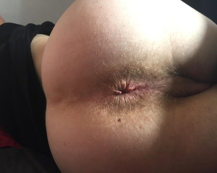 Lana Rouds Anus large