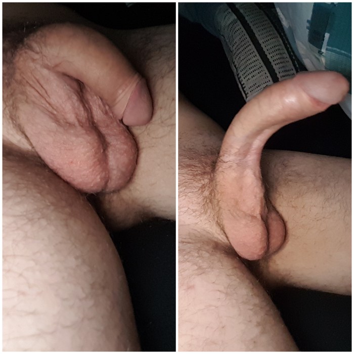 FIRST CUMSHOT MASTURBATION AFTER CIRCUMCISION GAY