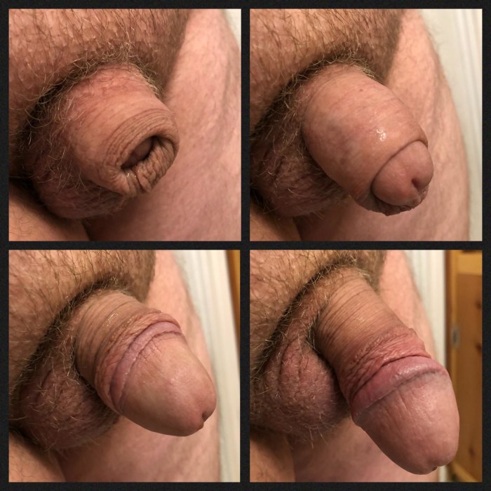 Uncircumcified Penis to Uncircuit Penis Copulation