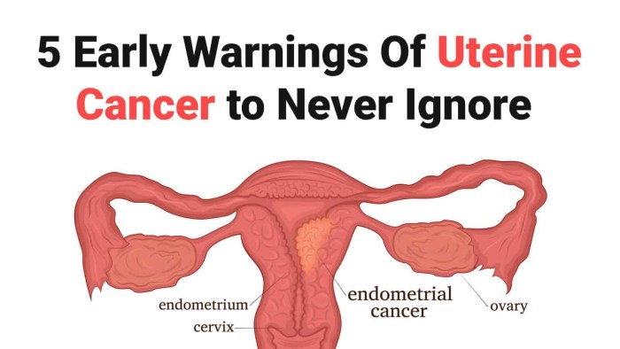 Breast Cancer Treatment