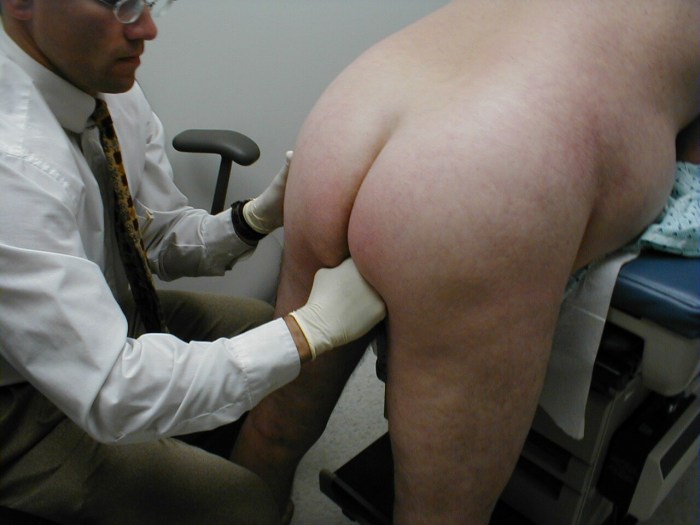 Hidden camera at the proctologist