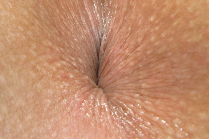 Mandy di open anus