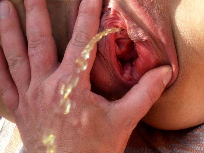 Widely opened vagina