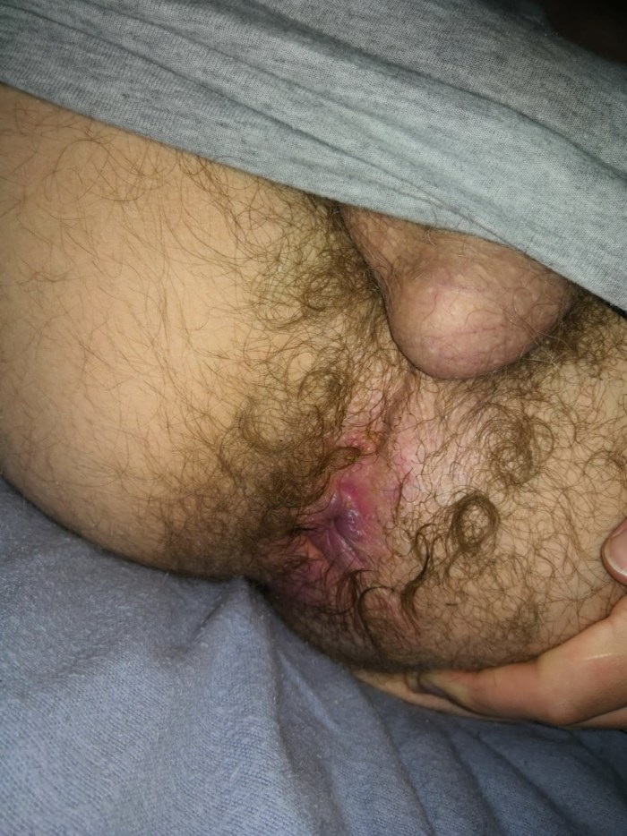 Street Crackwhore XXX Militar Anaal