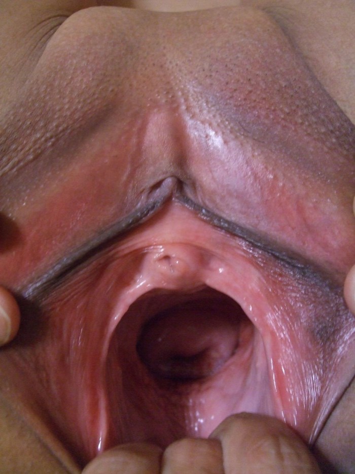 Vaginal fisting in the uterus