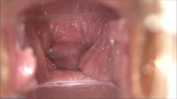 A video camera from the inside of the vagina