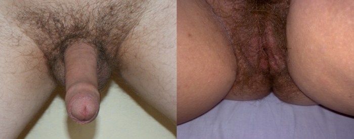 Very hairy female pubis