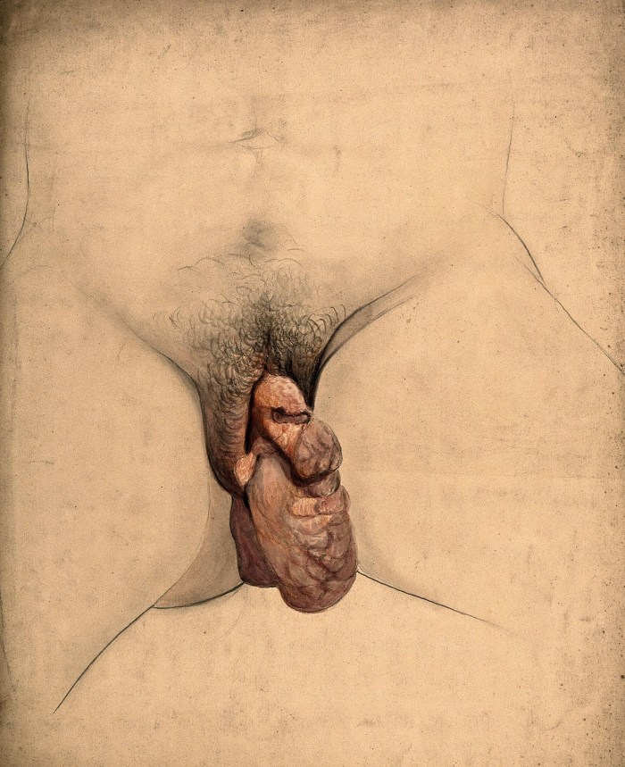 Naked women at the gynecologist