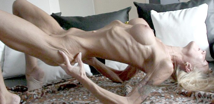 Anorexics with huge tits